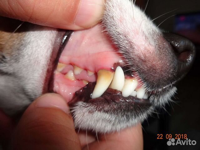 Ультрозвуковую чистка зубов