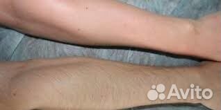 Эпиляция - шугаринг, воск, Skins Эпиляция - шугаринг, воск, Skins