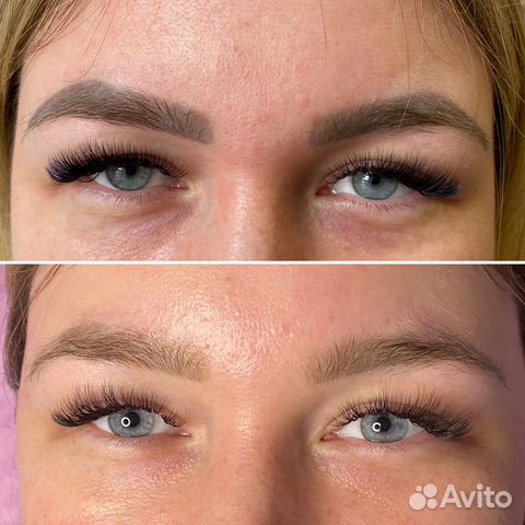 Осветление/ удаление тату/татуажа