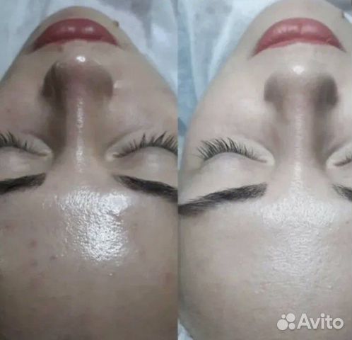 Три вида пилинга (на выбор) + «Фарфоровая куколка»